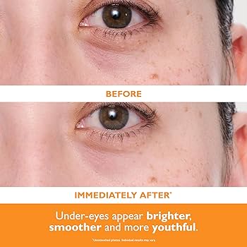 Göz altı üçün C vitamini ilə parlaqlaşdırıcı hidrogel patchlər 60 ədəd