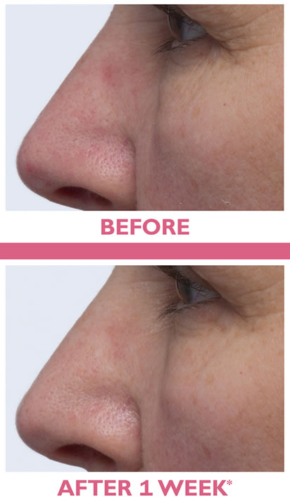 Yaşlanma əleyhinə və dəri baryerini dəstəkləyən üz kremi 50 ml